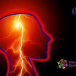 Епилепсията