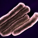 туберкулоза