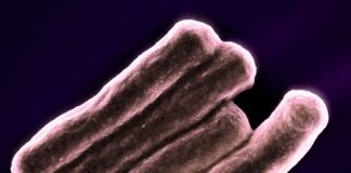 туберкулоза