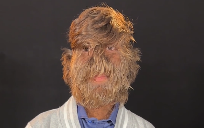 Лалит Патидар от Индия