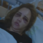 Пострадалата жена в Ямбол