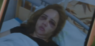 Пострадалата жена в Ямбол