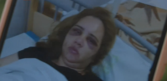 Пострадалата жена в Ямбол