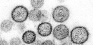 Хантавирус