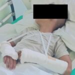 Пострадало дете