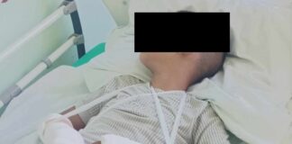 Пострадало дете