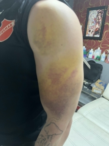 Нараняванията