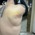 Нараняванията