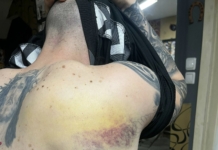 Нараняванията