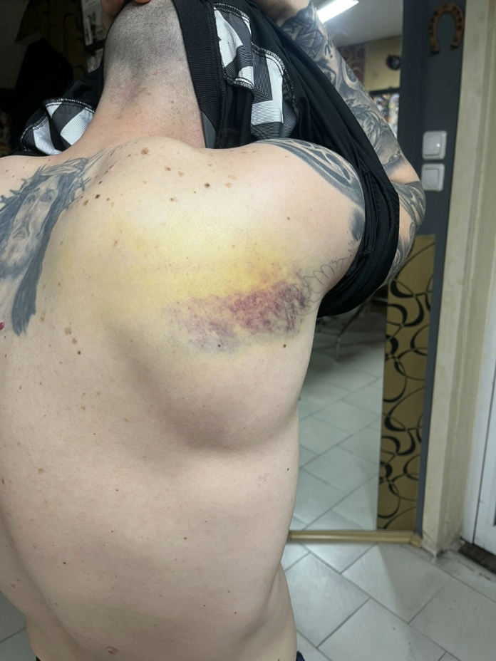 Нараняванията