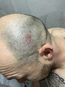 Нараняванията