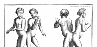 Сиямски близнаци