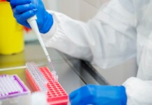 Няма съобщени случаи на антракс у нас