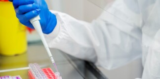 Няма съобщени случаи на антракс у нас