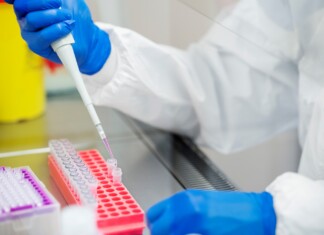 Няма съобщени случаи на антракс у нас