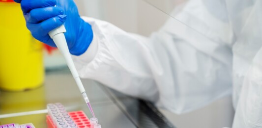 Няма съобщени случаи на антракс у нас